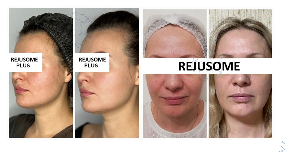  «Экзосомы – прорыв в косметологии 2024 года»: клиника «Люксор» об инновационной процедуре омоложения